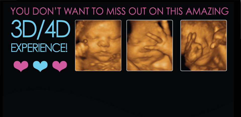 Miracle Me 3D/4D Ultrasound